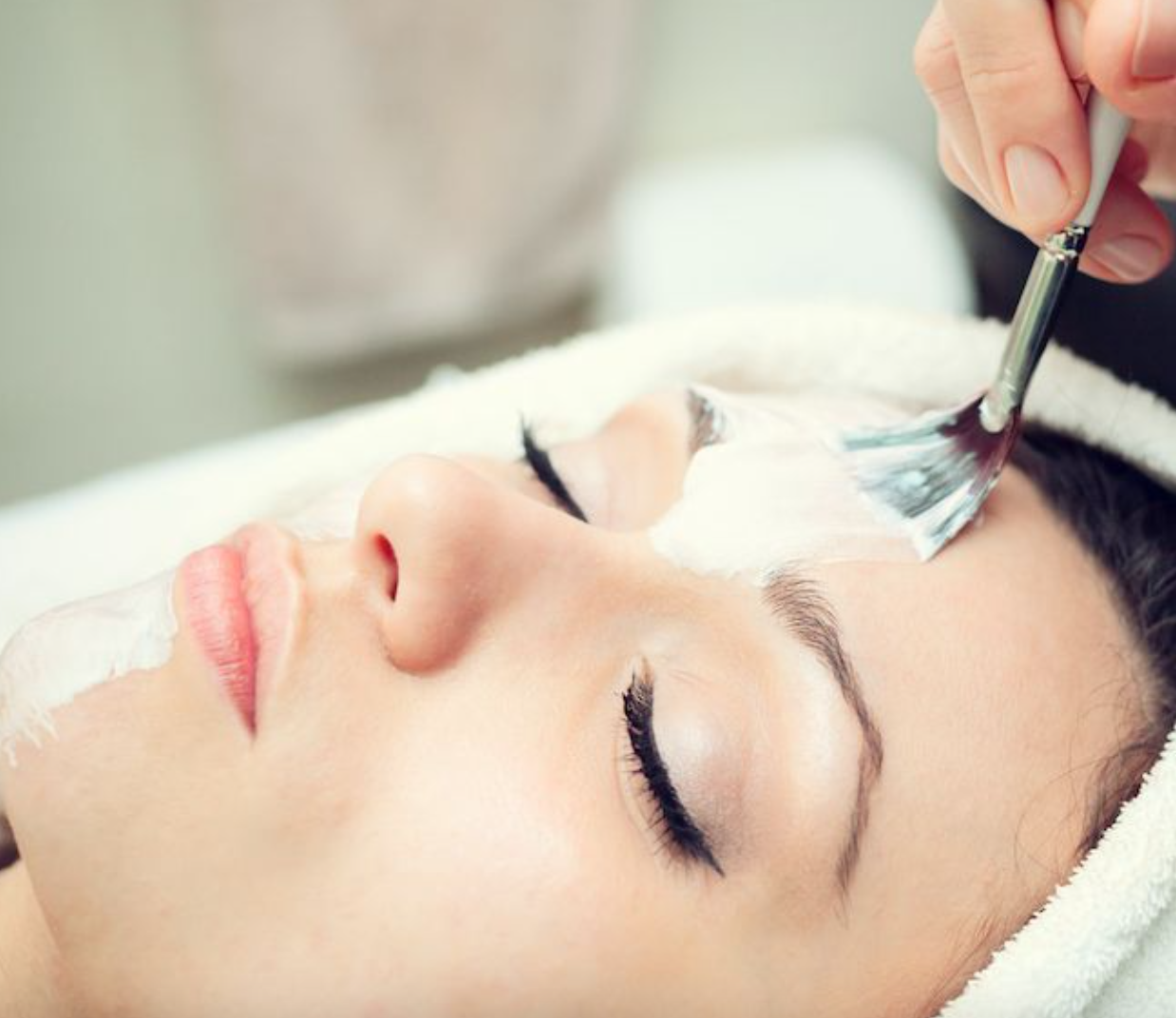 Chemical Peel Treatment
